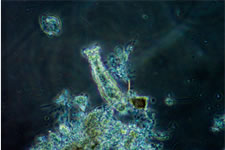 photo2: Bacteria inside a AQUACUBE (100x magnification)
