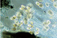 photo1: Bacteria inside a AQUACUBE (100x magnification)